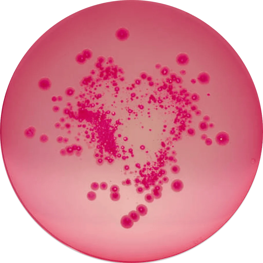 A pink petri dish with a culture spreading across it